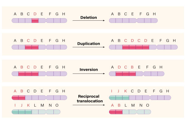 Anomalies de structure :
spontanément ou induites mutagènes.
-La délétion : la perte d’un segment de chromosome.
Syndrome du 